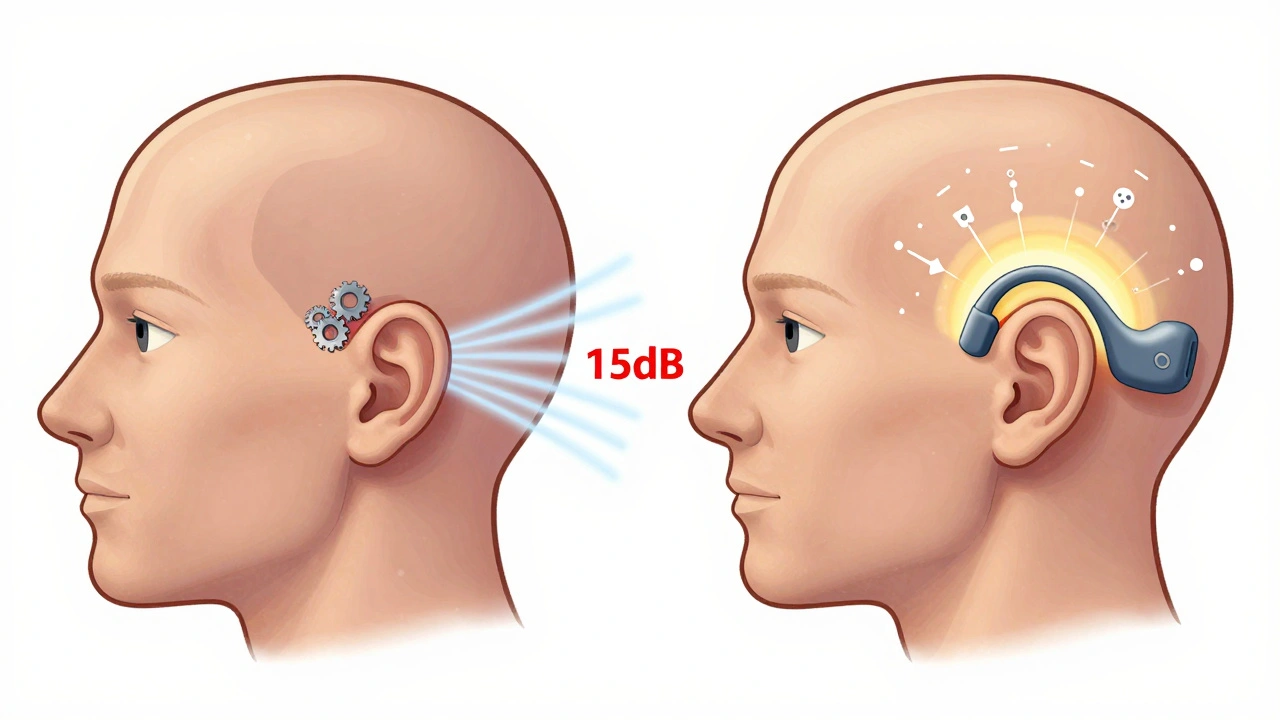 Side-by-side diagrams showing air vs. bone conduction pathways in the ear.